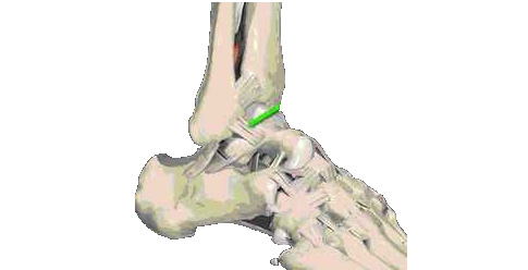 Forstuvet ankel illustration