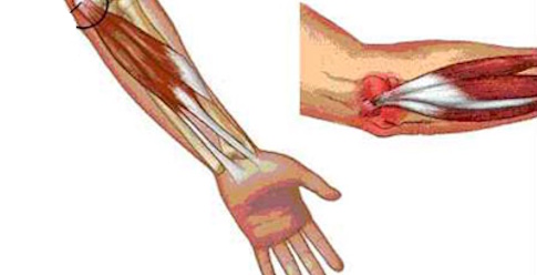 Tennisalbue illustration